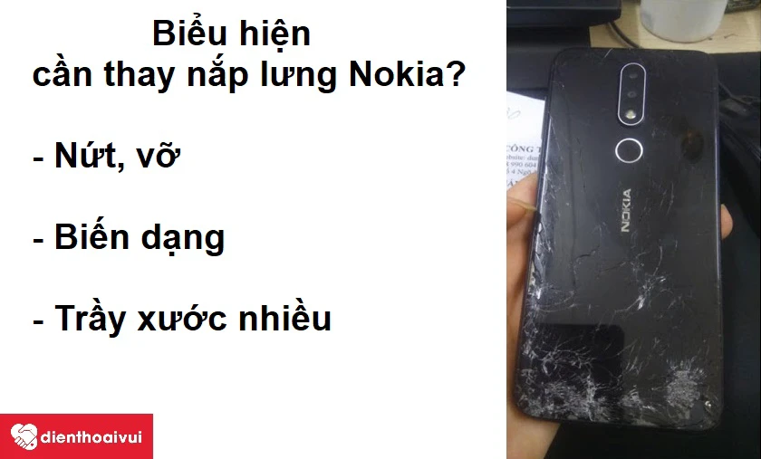 Dấu hiệu cho thấy bạn cần phải thay nắp mặt lưng điện thoại Nokia