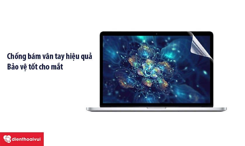 Miếng dán màn hình Macbook S-Case 13.3 inch