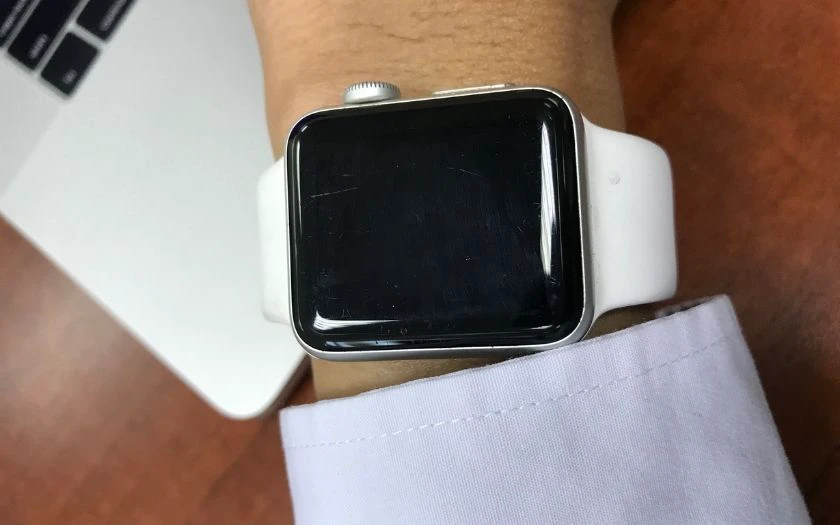 Tại sao xảy ra tình trạng tróc sơn trên Apple Watch