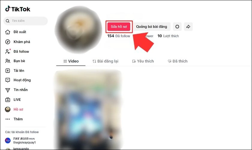 Nhấp vào nút Sửa hồ sơ (Edit Profile)