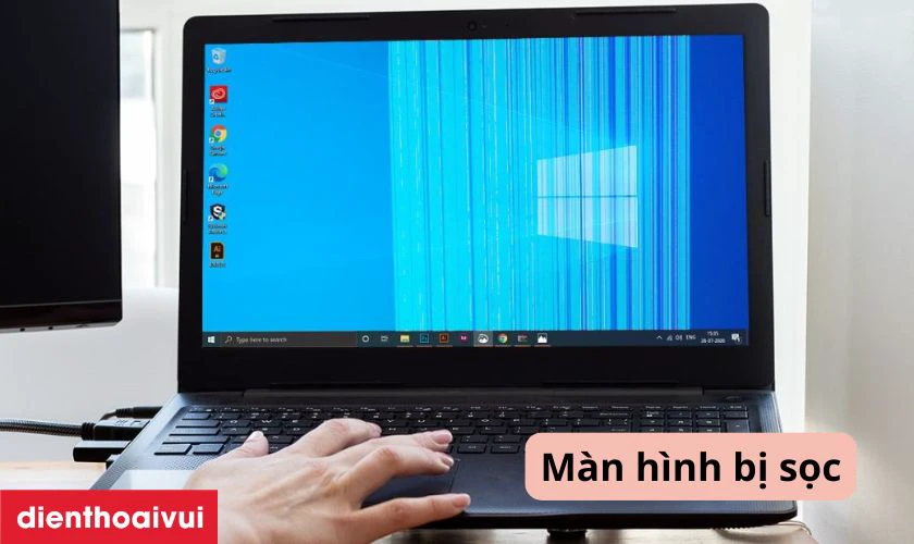Dấu hiệu cần thay m&agrave;n h&igrave;nh laptop Asus VivoBook X405