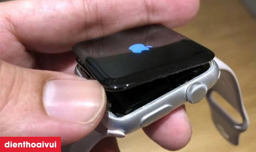 Nguy&ecirc;n nh&acirc;n pin Apple Watch Series