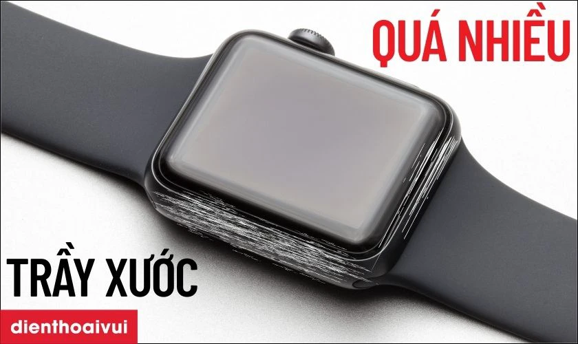 Khi n&agrave;o bạn cần thay vỏ Apple Watch?
