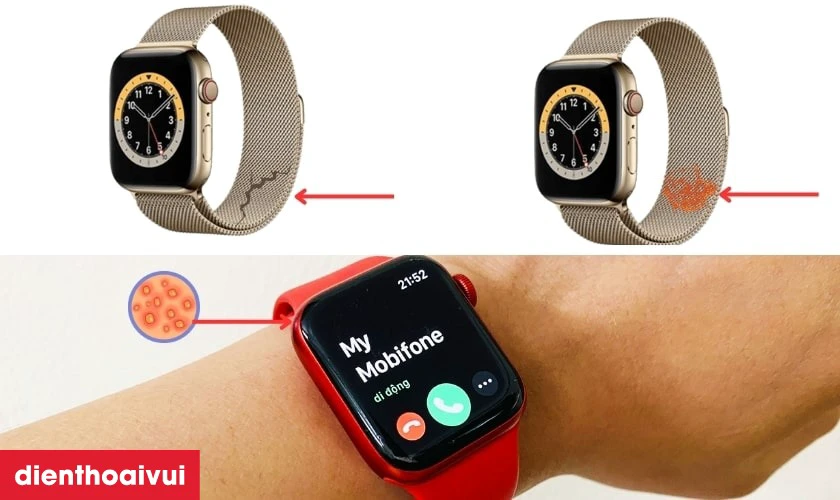 C&aacute;c dấu hiệu nhận biết bạn cần thay vỏ Apple Watch Series 6 mới