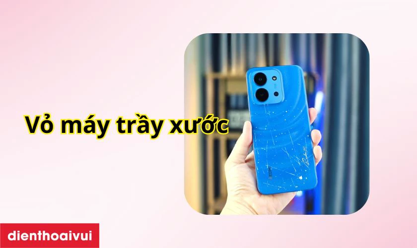 Khi nào bạn cần thay vỏ Xiaomi Redmi 15C?