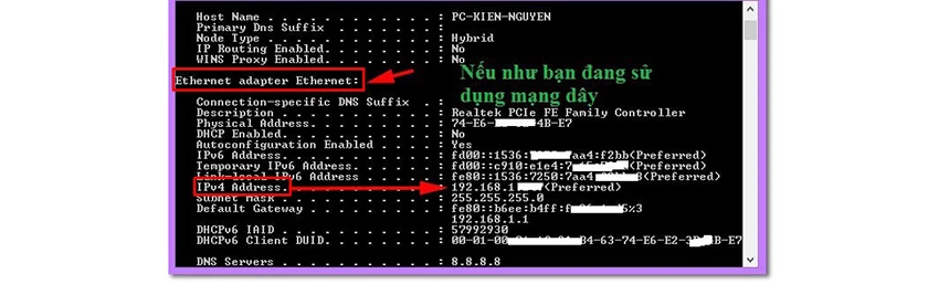 C&aacute;ch xem địa chỉ IP của m&aacute;y t&iacute;nh win 10 th&ocirc;ng qua cửa sổ CMD